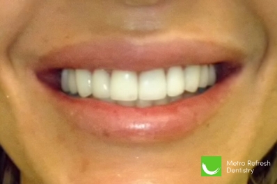 Close up of healthy teeth