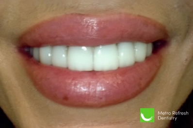 Close up of unhealthy teeth
