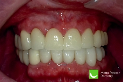 Close up of healthy teeth