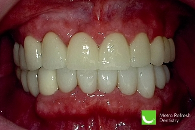 Close up of healthy teeth