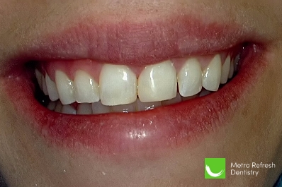 Close up of healthy teeth