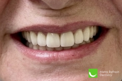 Close up of healthy teeth
