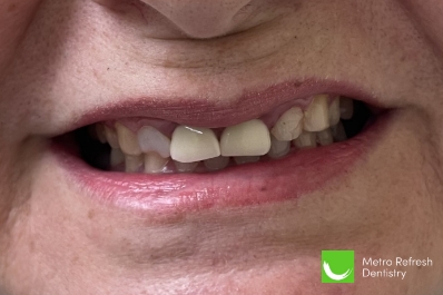 Close up of unhealthy teeth