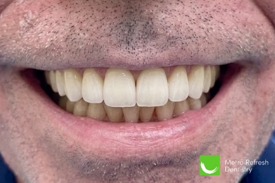 Close up of healthy teeth