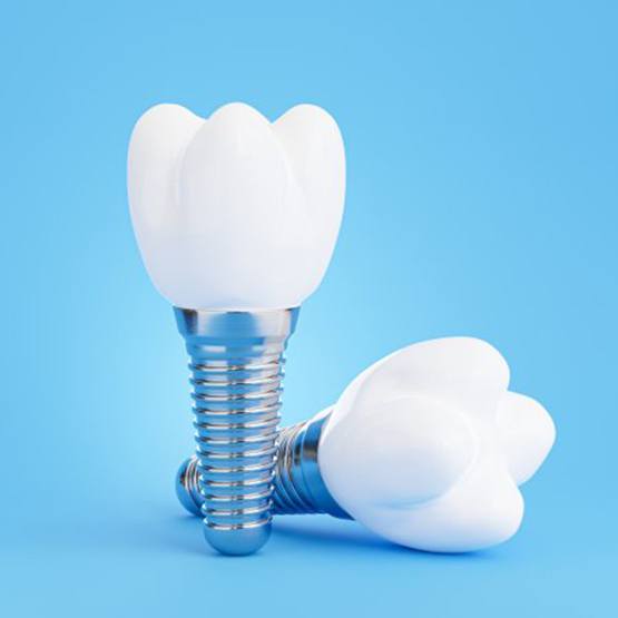 Two dental implants on a blue background