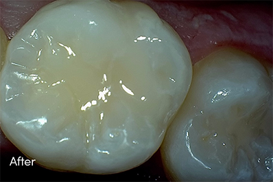 Close up of healthy teeth