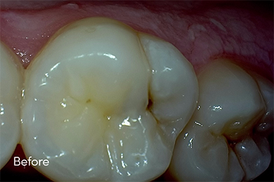 Close up of unhealthy teeth