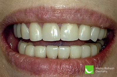 Close up of healthy teeth