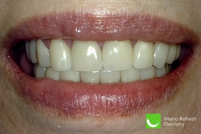 Close up of healthy teeth